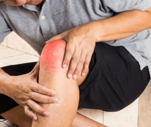 Glükózamin Glükózamin ízületekre